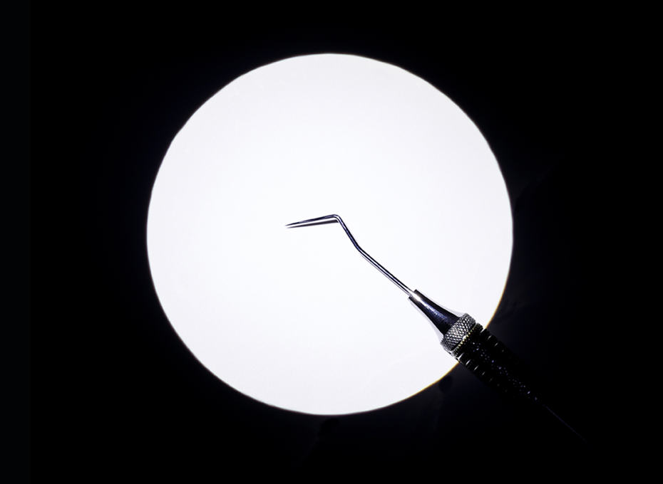 2023 11 TL Beam Intense TL Page